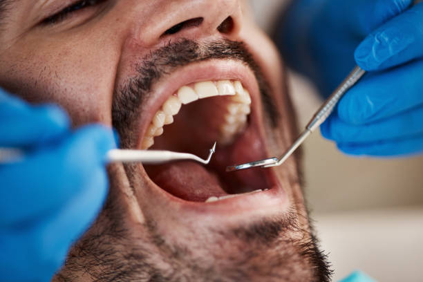 Best Dental Abscess Treatment in Landover, MD